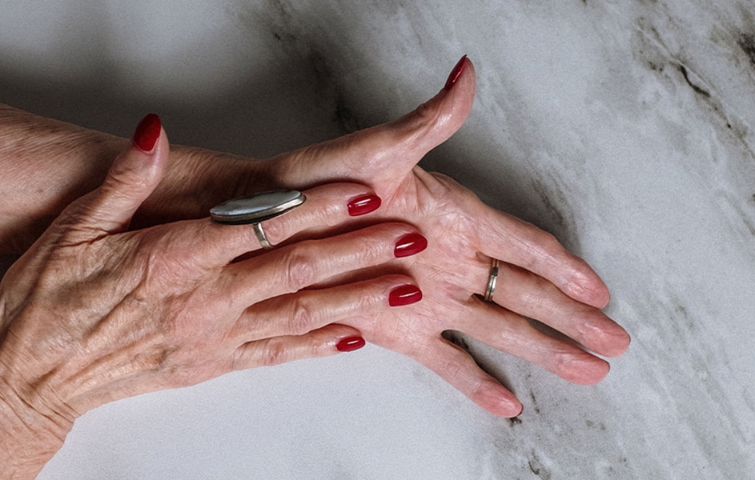 Tips To Get Rid Of Sunspots On Your Hands